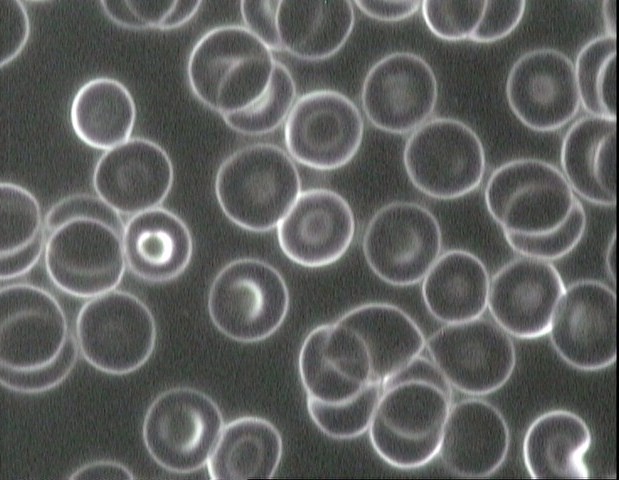 Eritrocitos en campo oscuro